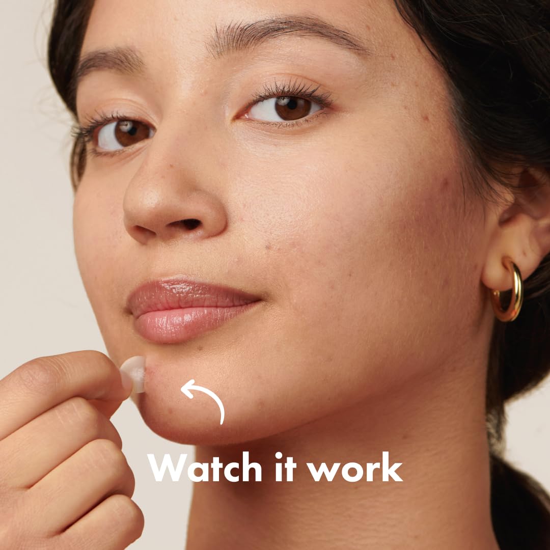 Mighty Patch Original patch from Hero Cosmetics – The #1 Hydrocolloid Acne Pimple Patch for Shrinking Zits and Whiteheads in 1 use; Nighttime Spot Stickers for Face and Skin (36 Count) - Image 12